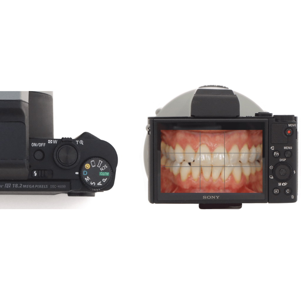 Sistem fotografie intraorala SONY Medical-D