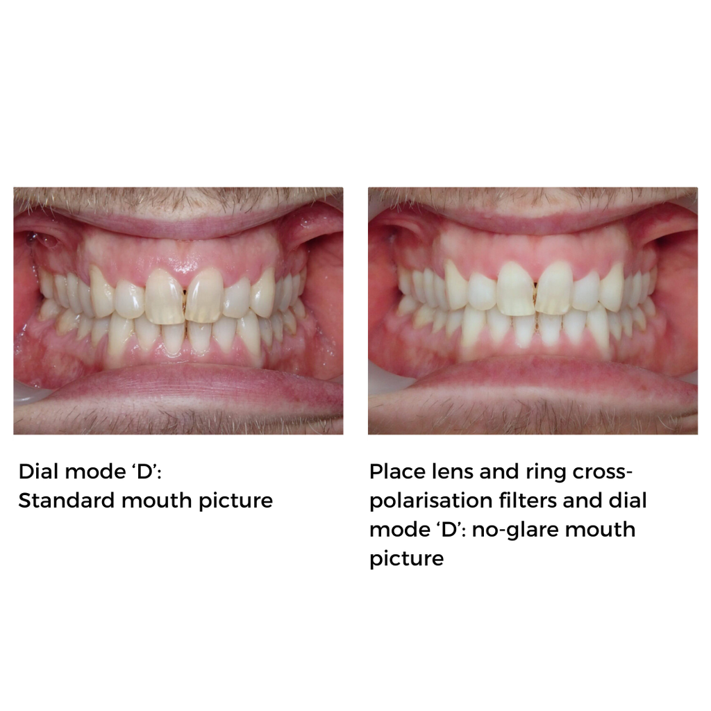 Sistem fotografie intraorala SONY Medical-D